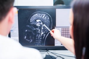 New York Social Security Disability Lawyers for Traumatic Injuries