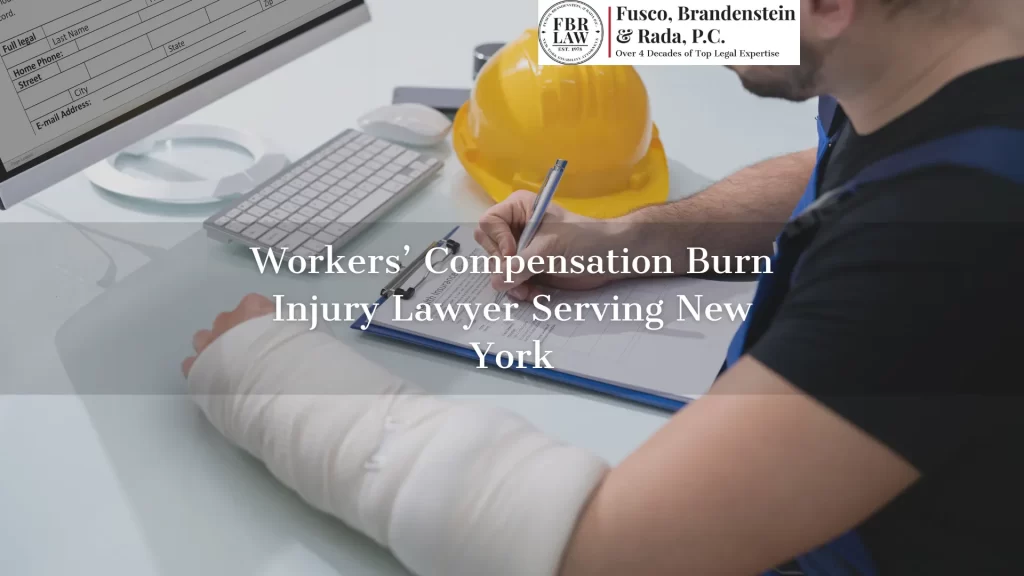 Workers’ Compensation Burn Injury Lawyer Serving New York